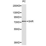 Western Blot - Anti-GHR Antibody (A2956) - Antibodies.com
