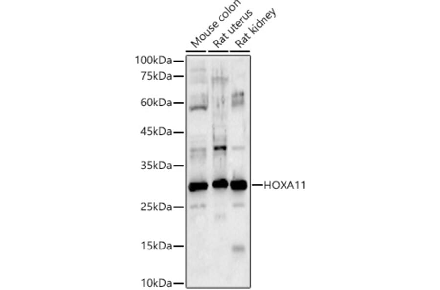 Western Blot - Anti-HOXA11 Antibody (A9119) - Antibodies.com