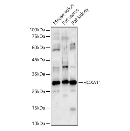 Western Blot - Anti-HOXA11 Antibody (A9119) - Antibodies.com