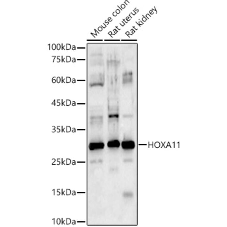 Western Blot - Anti-HOXA11 Antibody (A9119) - Antibodies.com