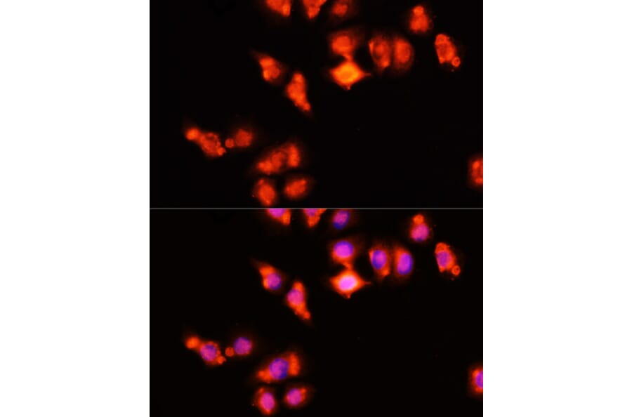 Immunofluorescence - Anti-HOXA11 Antibody (A9119) - Antibodies.com