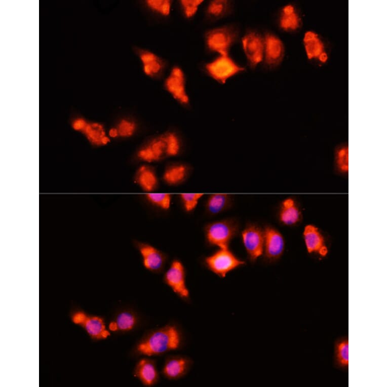 Immunofluorescence - Anti-HOXA11 Antibody (A9119) - Antibodies.com