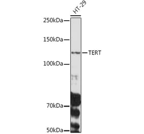 Western Blot - Anti-Telomerase reverse transcriptase Antibody (A9120) - Antibodies.com