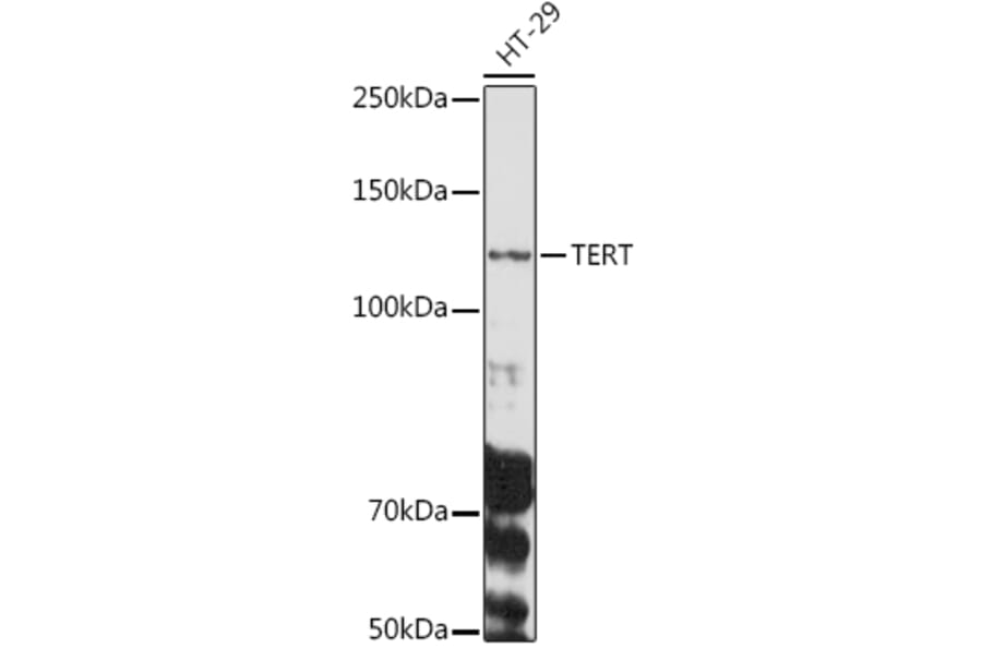 Western Blot - Anti-Telomerase reverse transcriptase Antibody (A9120) - Antibodies.com