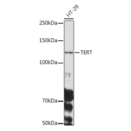 Western Blot - Anti-Telomerase reverse transcriptase Antibody (A9120) - Antibodies.com