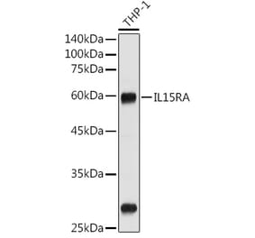 Western Blot - Anti-IL-15RA Antibody (A9121) - Antibodies.com