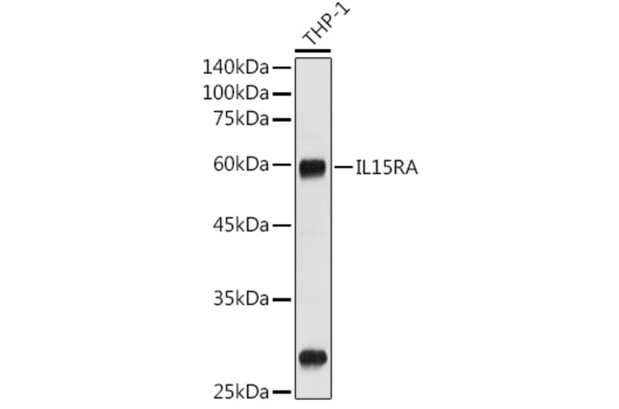 Western Blot - Anti-IL-15RA Antibody (A9121) - Antibodies.com