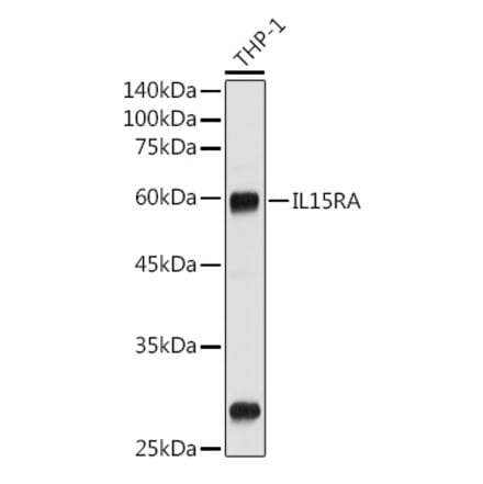 Western Blot - Anti-IL-15RA Antibody (A9121) - Antibodies.com
