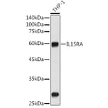 Western Blot - Anti-IL-15RA Antibody (A9121) - Antibodies.com