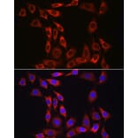 Immunofluorescence - Anti-IL-15RA Antibody (A9121) - Antibodies.com