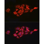 Immunofluorescence - Anti-IL-15RA Antibody (A9121) - Antibodies.com