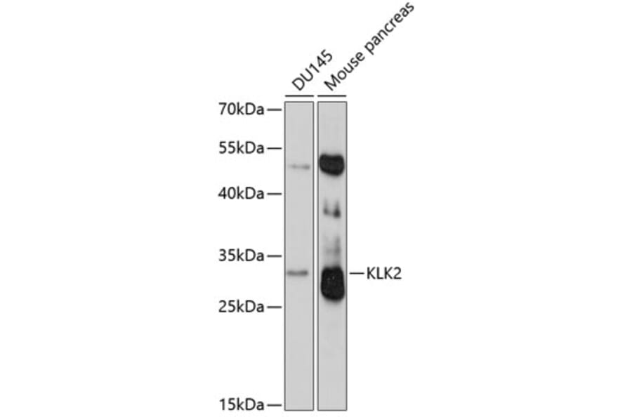 Western Blot - Anti-Kallikrein 2 / KLK2 Antibody (A9122) - Antibodies.com