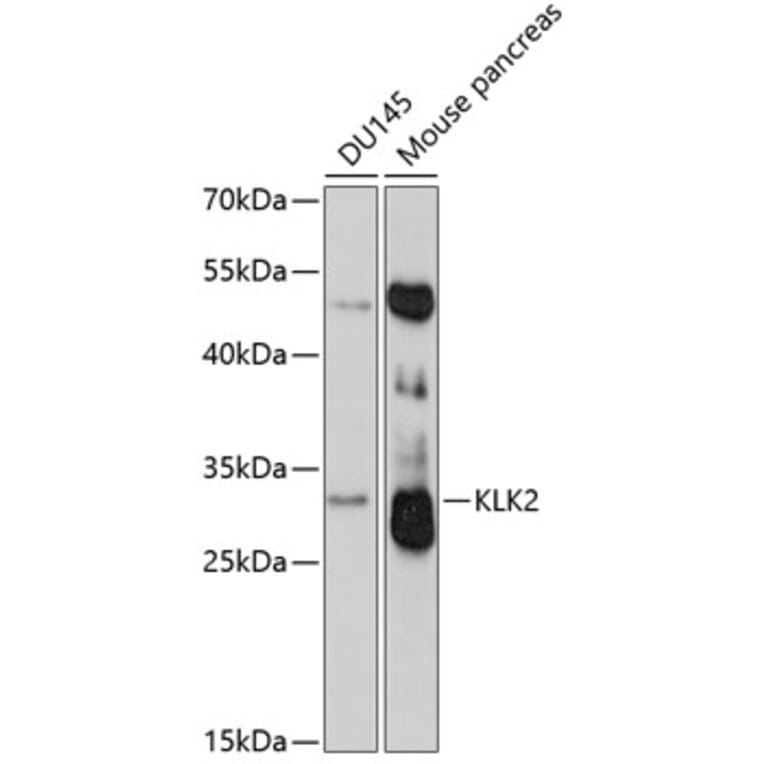 Western Blot - Anti-Kallikrein 2 / KLK2 Antibody (A9122) - Antibodies.com