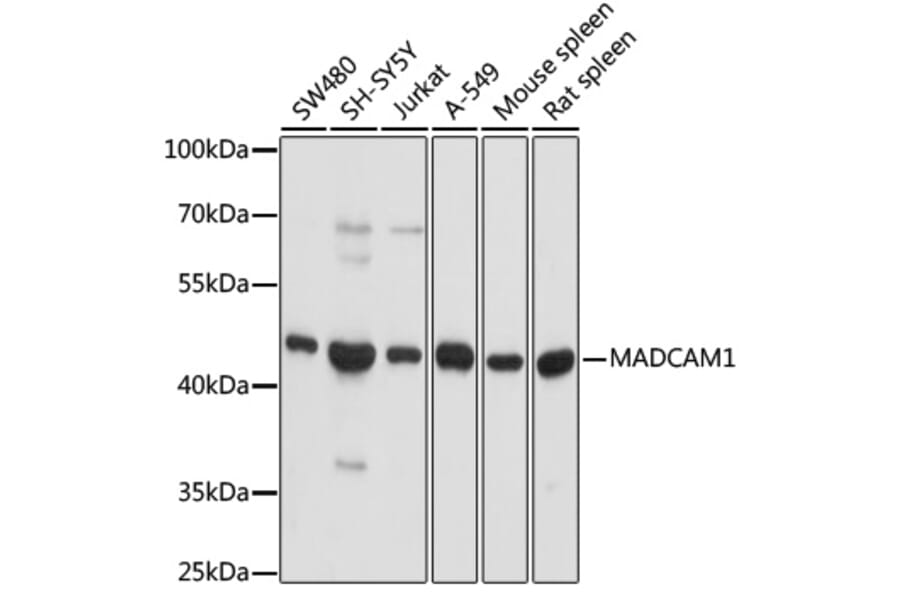Western Blot - Anti-MAdCAM1 Antibody (A9125) - Antibodies.com