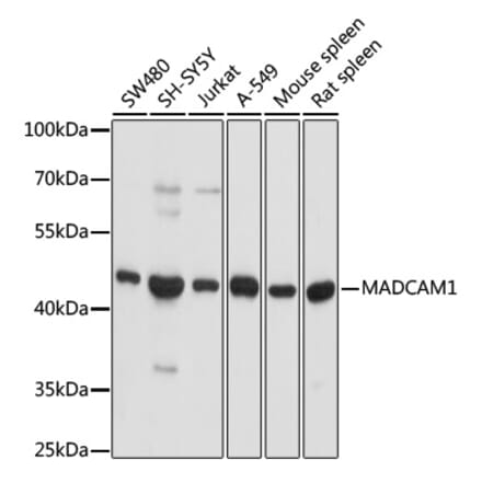 Western Blot - Anti-MAdCAM1 Antibody (A9125) - Antibodies.com