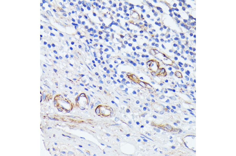 Immunohistochemistry - Anti-MAdCAM1 Antibody (A9125) - Antibodies.com