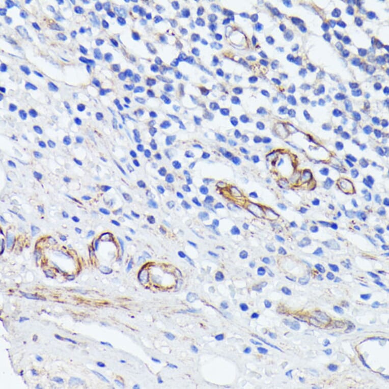 Immunohistochemistry - Anti-MAdCAM1 Antibody (A9125) - Antibodies.com