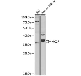 Western Blot - Anti-MC2-R Antibody (A9128) - Antibodies.com