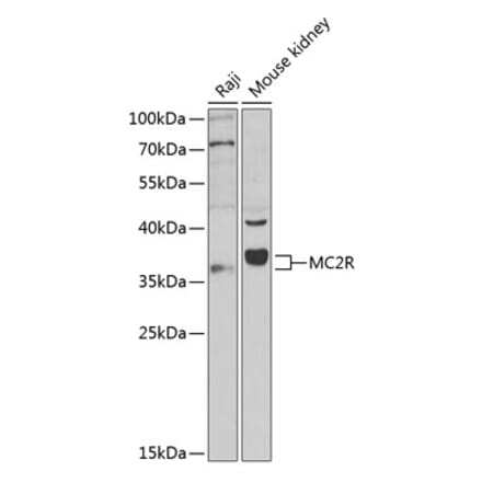 Western Blot - Anti-MC2-R Antibody (A9128) - Antibodies.com
