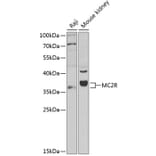 Western Blot - Anti-MC2-R Antibody (A9128) - Antibodies.com