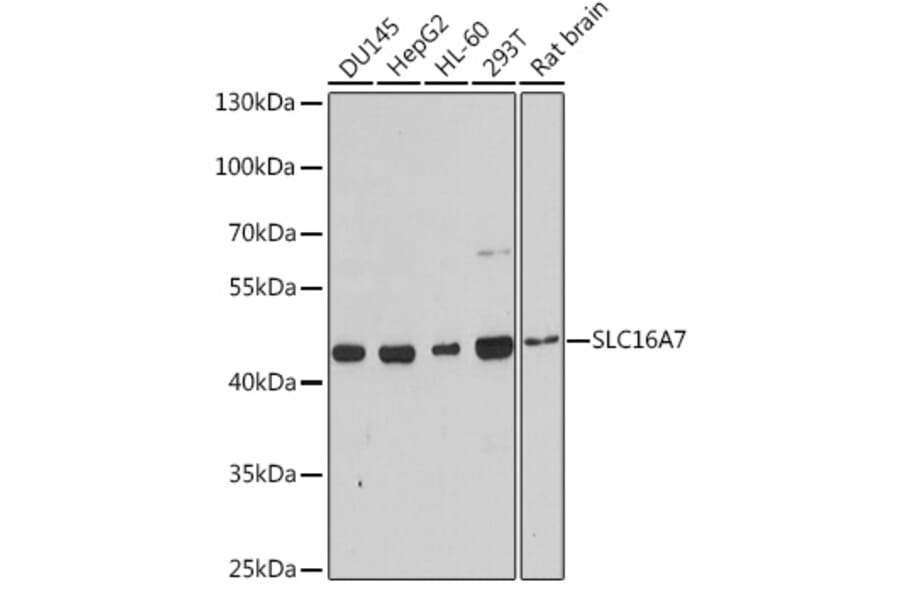 Western Blot - Anti-MCT2 Antibody (A9130) - Antibodies.com
