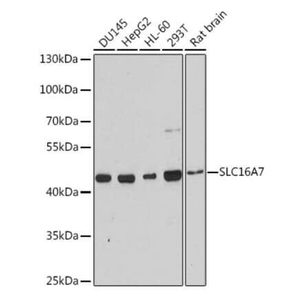 Western Blot - Anti-MCT2 Antibody (A9130) - Antibodies.com