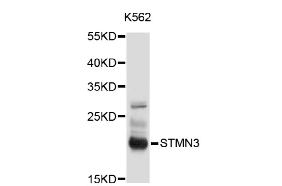 Western Blot - Anti-STMN3 Antibody (A3025) - Antibodies.com