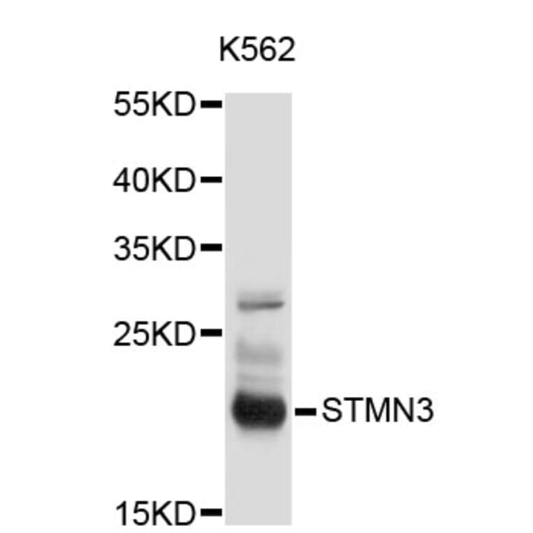 Western Blot - Anti-STMN3 Antibody (A3025) - Antibodies.com