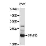 Western Blot - Anti-STMN3 Antibody (A3025) - Antibodies.com