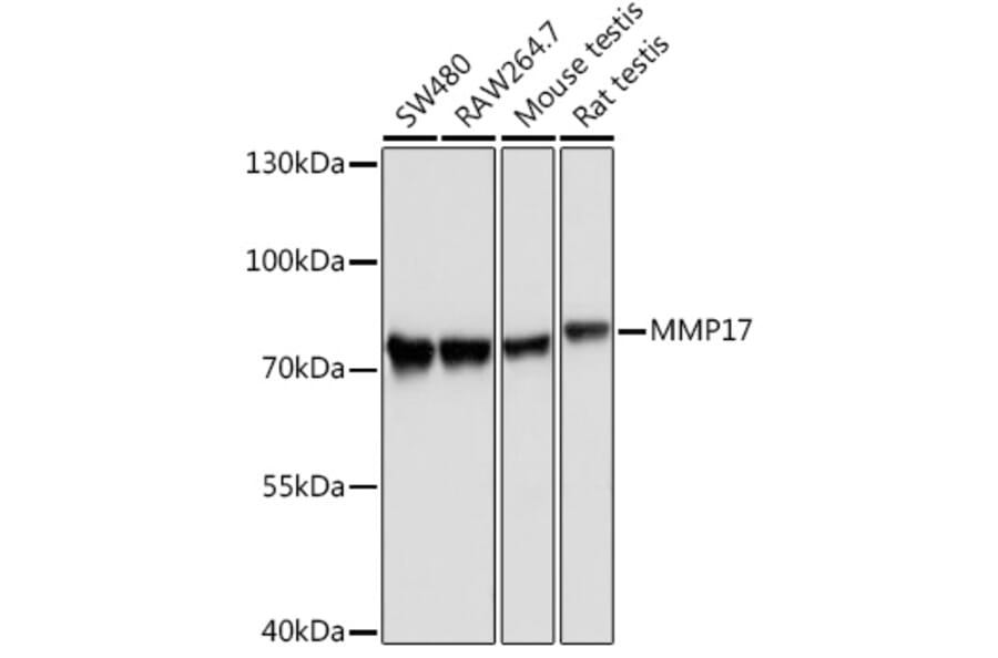 Western Blot - Anti-MT4-MMP Antibody (A9132) - Antibodies.com