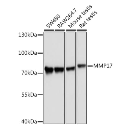 Western Blot - Anti-MT4-MMP Antibody (A9132) - Antibodies.com