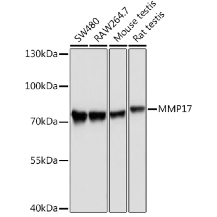 Western Blot - Anti-MT4-MMP Antibody (A9132) - Antibodies.com