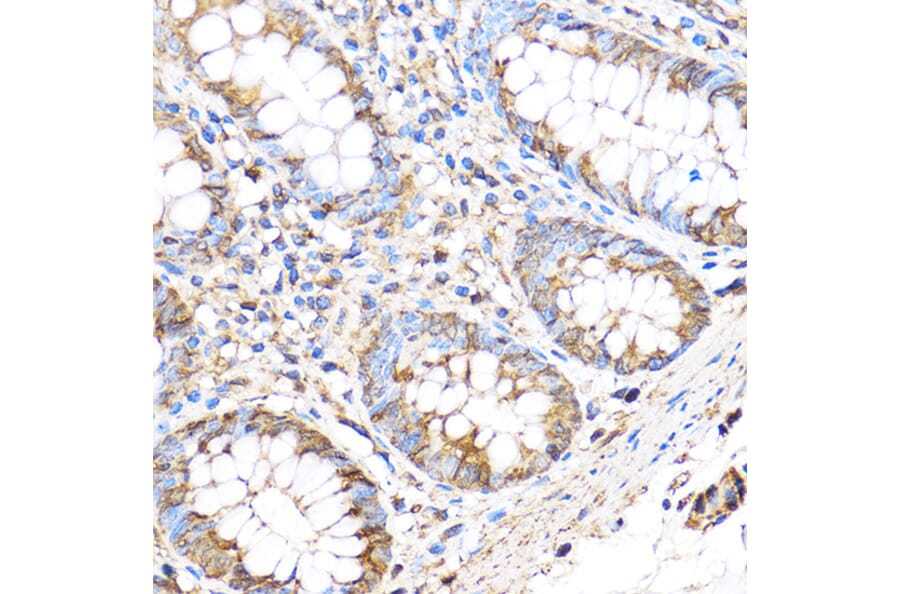 Immunohistochemistry - Anti-MT4-MMP Antibody (A9132) - Antibodies.com