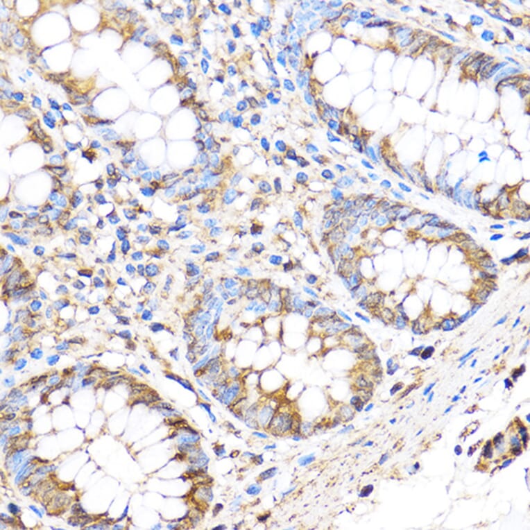Immunohistochemistry - Anti-MT4-MMP Antibody (A9132) - Antibodies.com