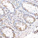 Immunohistochemistry - Anti-MT4-MMP Antibody (A9132) - Antibodies.com