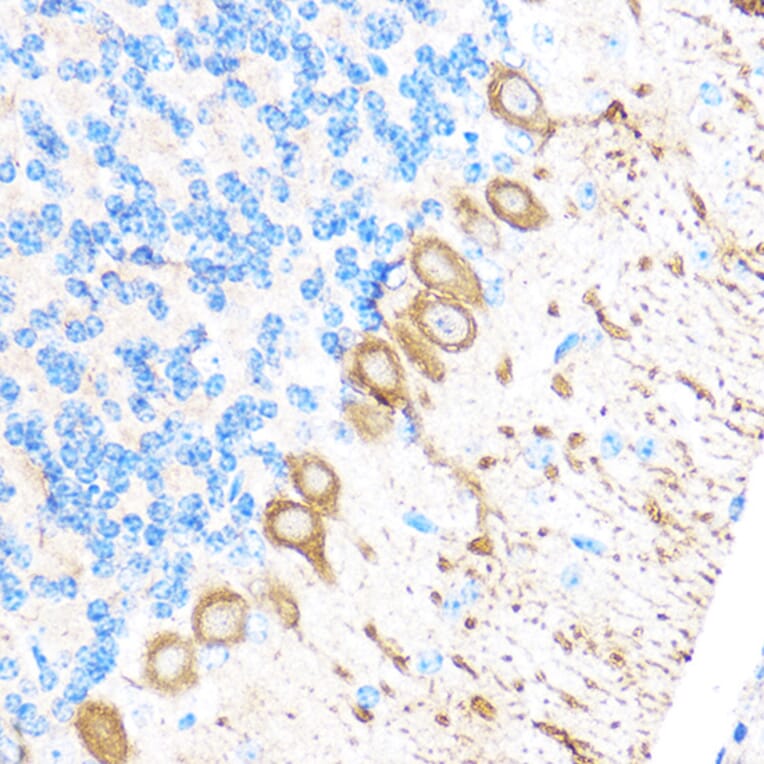 Immunohistochemistry - Anti-MT4-MMP Antibody (A9132) - Antibodies.com