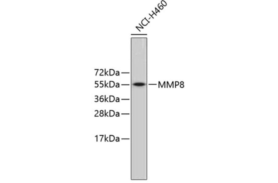 Western Blot - Anti-MMP8 Antibody (A3031) - Antibodies.com