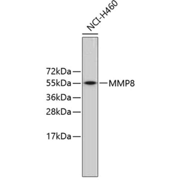 Western Blot - Anti-MMP8 Antibody (A3031) - Antibodies.com
