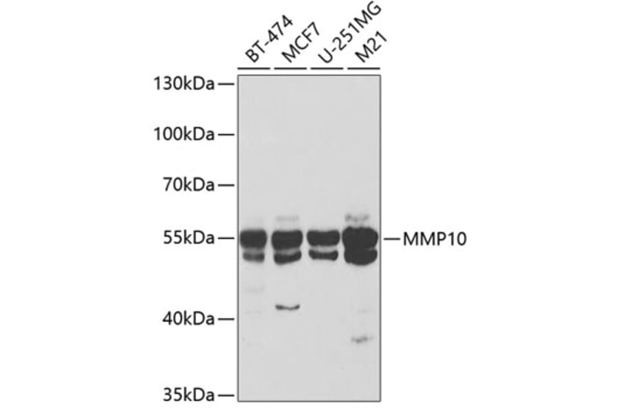 Western Blot - Anti-MMP10 Antibody (A9134) - Antibodies.com