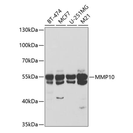 Western Blot - Anti-MMP10 Antibody (A9134) - Antibodies.com