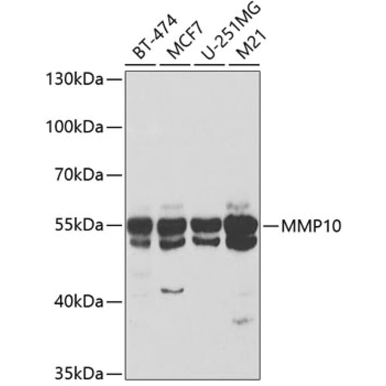 Western Blot - Anti-MMP10 Antibody (A9134) - Antibodies.com