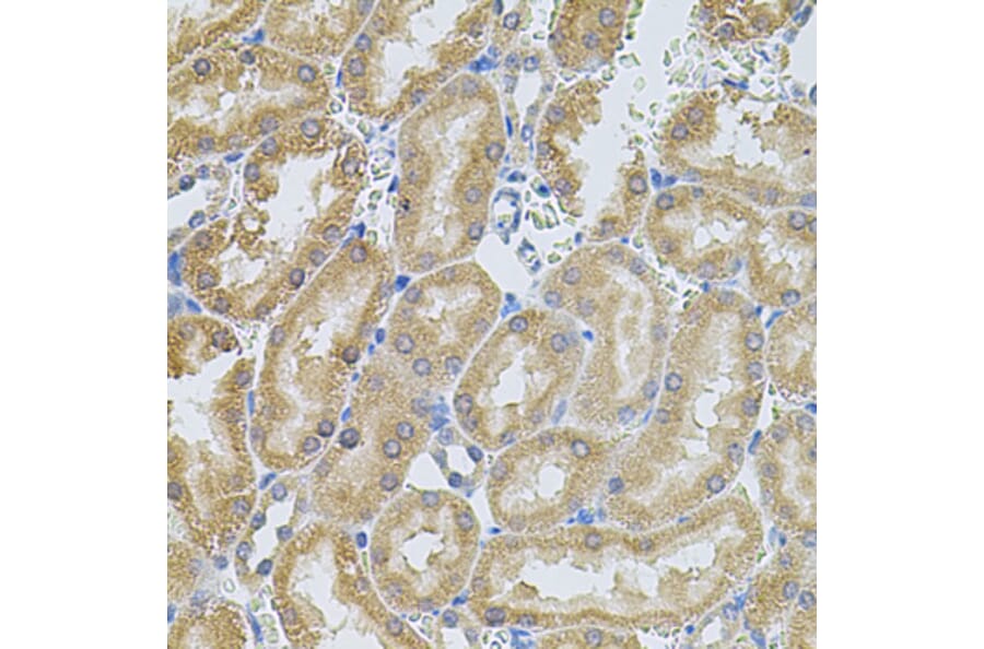 Immunohistochemistry - Anti-MMP10 Antibody (A9134) - Antibodies.com
