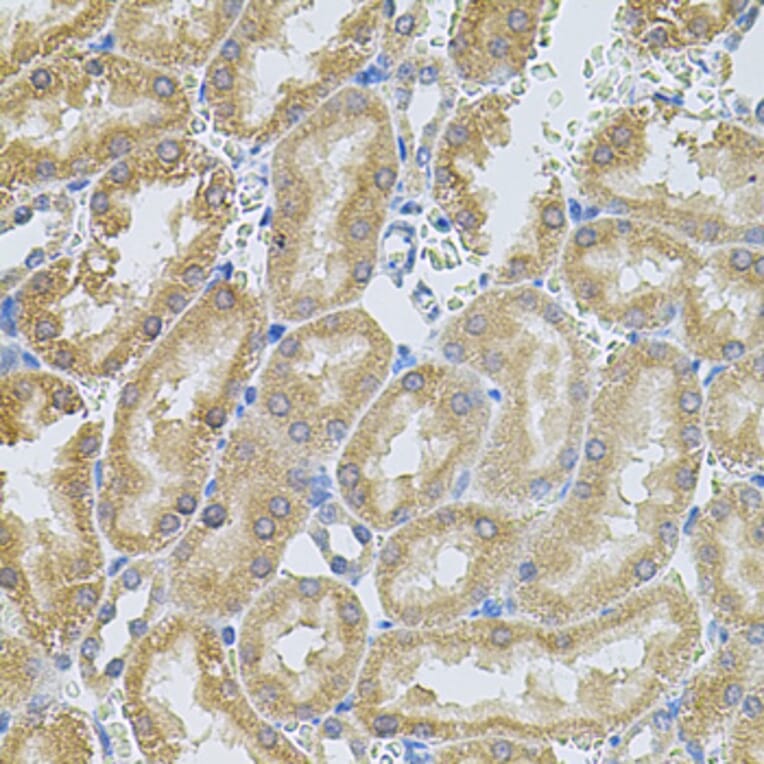 Immunohistochemistry - Anti-MMP10 Antibody (A9134) - Antibodies.com