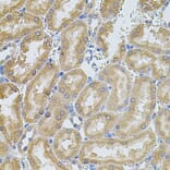 Immunohistochemistry - Anti-MMP10 Antibody (A9134) - Antibodies.com