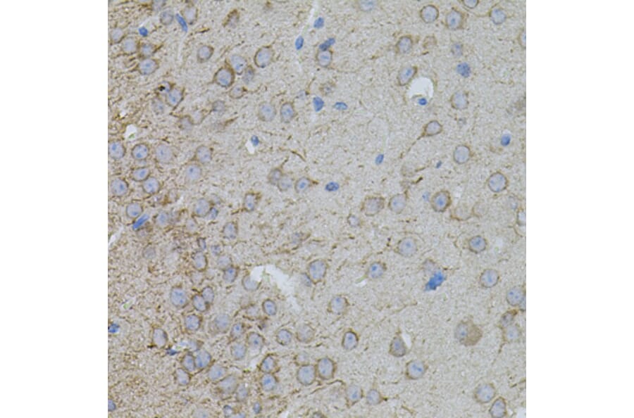 Immunohistochemistry - Anti-MMP10 Antibody (A9134) - Antibodies.com