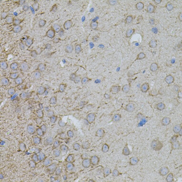 Immunohistochemistry - Anti-MMP10 Antibody (A9134) - Antibodies.com