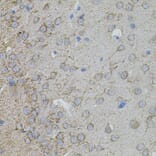Immunohistochemistry - Anti-MMP10 Antibody (A9134) - Antibodies.com