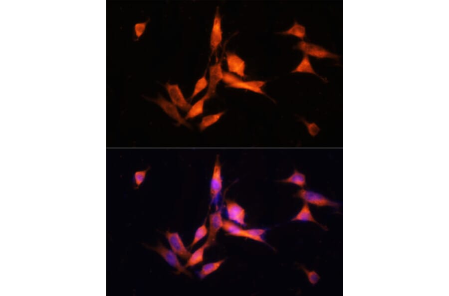 Immunofluorescence - Anti-MMP10 Antibody (A9134) - Antibodies.com