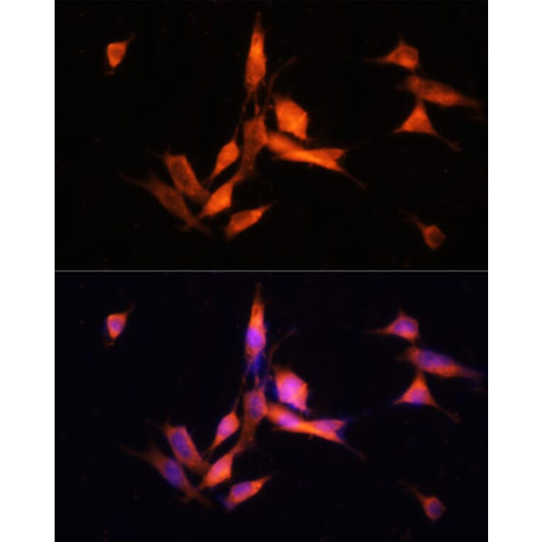 Immunofluorescence - Anti-MMP10 Antibody (A9134) - Antibodies.com