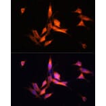 Immunofluorescence - Anti-MMP10 Antibody (A9134) - Antibodies.com